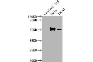 Immunoprecipitating FOXA1 in Hela whole cell lysate Lane 1: Rabbit control IgG instead of ABIN7127498 in Hela whole cell lysate.