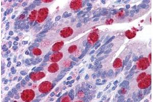 Human Small Intestine: Formalin-Fixed, Paraffin-Embedded (FFPE)