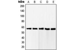 Western blot analysis of RAB11FIP2 expression in Jurkat (A), HeLa (B), MCF7 (C), A431 (D), HEK293 (E) whole cell lysates. (RAB11FIP2 anticorps  (Center))