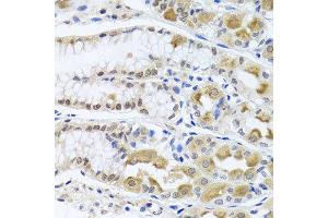 Immunohistochemistry of paraffin-embedded human gastric using TRMT1 antibody at dilution of 1:100 (x40 lens). (TRMT1 anticorps)
