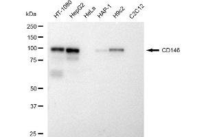 anti-Melanoma Cell Adhesion Molecule (MCAM) antibody