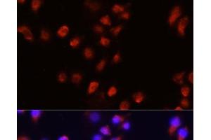 Immunofluorescence analysis of A431 cells using ACVR2A Polyclonal Antibody at dilution of 1:100 (40x lens). (ACVR2A anticorps)