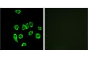 Immunofluorescence analysis of A549 cells, using MRPL32 Antibody. (MRPL32 anticorps  (AA 101-150))