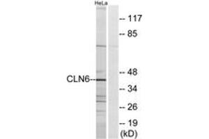 Western blot analysis of extracts from HeLa cells, using CLN6 Antibody.