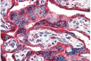 Human Placenta (formalin-fixed, paraffin-embedded) stained with HSP90B1 antibody ABIN462106 at 10 ug/ml followed by biotinylated secondary antibody, alkaline phosphatase-streptavidin and chromogen. (GRP94 anticorps)