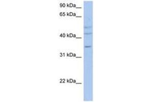 Image no. 1 for anti-PXYLP1 / ACPL2 (AA 71-120) antibody (ABIN6743334) (PXYLP1 / ACPL2 (AA 71-120) anticorps)