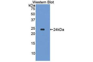 Western Blotting (WB) image for anti-Amyloid P Component, Serum (APCS) (AA 20-223) antibody (ABIN1174754) (APCS anticorps  (AA 20-223))