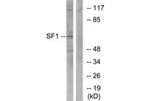 Western blot analysis of extracts from COLO205 cells, using SF1 (Ab-82) Antibody. (Splicing Factor 1 anticorps  (AA 48-97))