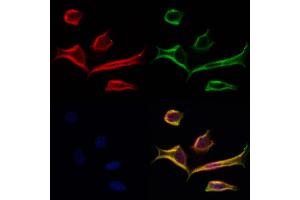 ABIN6264064 and ABIN6277250 staining Hela cells by IF/ICC. (PCBP2 anticorps  (Internal Region))