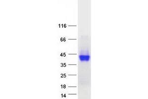 Validation with Western Blot