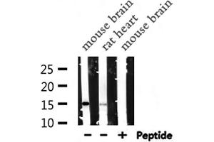 Western blot analysis of PFN1  expression in various lysates (PFN1 anticorps  (C-Term))