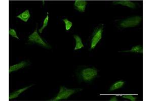 Immunofluorescence of monoclonal antibody to MAPK3 on HeLa cell. (ERK1 anticorps  (AA 279-379))