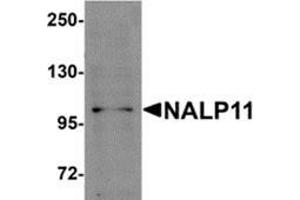Western blot analysis of NALP11 in HeLa cell lysate with NALP11 antibody at 1 μg/ml. (NLRP11 anticorps  (C-Term))