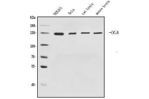 Western blot analysis of MGEA5/OGA using anti-MGEA5/OGA antibody (ABIN7602902).