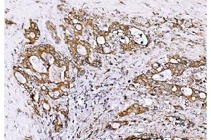 IHC analysis of GPR54/KISS1R using anti-GPR54/KISS1R antibody (ABIN7602153). (KISS1R anticorps  (AA 60-373))