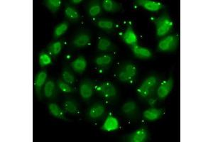 Immunofluorescence analysis of MCF7 cells using DR1 antibody (ABIN6130316, ABIN6139817, ABIN6139819 and ABIN6217241). (DR1 anticorps  (AA 1-176))