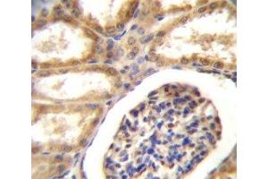 DDR1 antibody immunohistochemistry analysis in formalin fixed and paraffin embedded human kidney tissue.