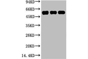 Western blot analysis of 1) Hela, 2) Mouse Kidney tissue, 3) Rat Heart tissue, diluted at 1:5000. (TUBB3 anticorps)
