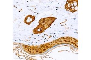 Immunohistochemistry of paraffin embedded rat skin using Annexin-A8 (ABIN7073071) at dilution of 1: 1600 (400x lens) (Annexin VIII anticorps)