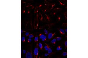 Confocal immunofluorescence analysis of U2OS cells using Vimentin Polyclonal Antibody (ABIN3016291, ABIN3016292, ABIN3016293 and ABIN6219693) at dilution of 1:100. (Vimentin anticorps  (AA 1-200))
