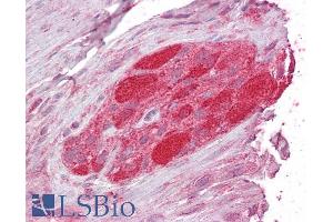 ABIN184697 (2. (STUB1 anticorps  (C-Term))