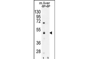 Western blot analysis of SD8 Antibody (N-term) Pab (ABIN655974 and ABIN2845359) pre-incubated without(lane 1) and with(lane 2) blocking peptide in mouse liver tissue lysate. (SAMD8 anticorps  (N-Term))