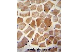 WISP2 Antibody (Center) A immunohistochemistry analysis in formalin fixed and paraffin embedded human skeletal muscle followed by peroxidase conjugation of the secondary antibody and DAB staining. (WISP2 anticorps  (AA 87-116))