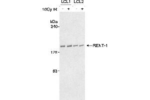 Western Blotting (WB) image for anti-UPF1 Regulator of Nonsense Transcripts Homolog (UPF1) (AA 250-300) antibody (ABIN7449176)