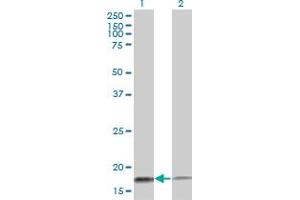 Western Blot analysis of TOMM20 expression in transfected 293T cell line by TOMM20 monoclonal antibody (M01), clone 4F3.