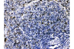 GC1q R was detected in paraffin-embedded sections of rat spleen tissues using rabbit anti- GC1q R Antigen Affinity purified polyclonal antibody (Catalog # ) at 1 µg/mL.