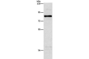 Western Blot analysis of Hela cell using NOL9 Polyclonal Antibody at dilution of 1:1250 (NOL9 anticorps)