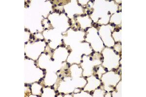 Immunohistochemistry of paraffin-embedded mouse lung using E2F6 antibody (ABIN5973627) at dilution of 1/200 (40x lens). (E2F6 anticorps)