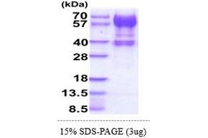 SDS-PAGE (SDS) image for Interleukin 15 Receptor, alpha (IL15RA) (AA 31-205) protein (hIgG-His-tag) (ABIN7529371) (IL15RA Protein (AA 31-205) (hIgG-His-tag))