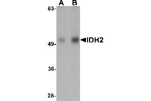 Western Blotting (WB) image for anti-Isocitrate Dehydrogenase 2 (NADP+), Mitochondrial (IDH2) (N-Term) antibody (ABIN1031407) (IDH2 anticorps  (N-Term))
