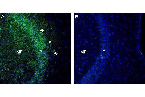 Expression of TSH Receptor in mouse hippocampus. (TSH receptor anticorps  (Extracellular, N-Term))