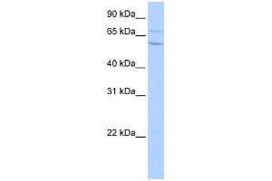 WB Suggested Anti-CPN2 Antibody Titration: 0. (CPN2 anticorps  (N-Term))