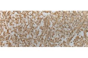 Immunohistochemistry of paraffin-embedded Human tonsil tissue using ZNF8 Polyclonal Antibody at dilution of 1:40(x200)