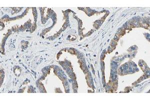 ABIN6277658 at 1/100 staining Human prostate tissue by IHC-P. (TK1 anticorps  (N-Term))