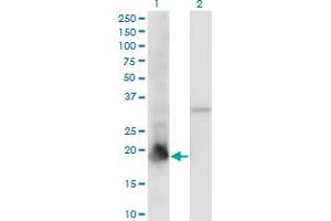 Western Blot analysis of PPIL1 expression in transfected 293T cell line by PPIL1 monoclonal antibody (M01), clone 2C2. (PPIL1 anticorps  (AA 76-166))