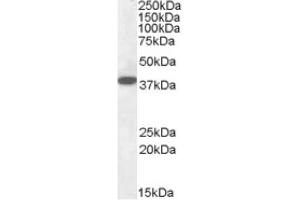 Image no. 1 for anti-Epilepsy, Progressive Myoclonus Type 2A, Lafora Disease (Laforin) (EPM2A) (Internal Region), (Isoform A) antibody (ABIN375087) (EPM2A anticorps  (Internal Region, Isoform A))