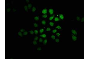 Immunofluorescence staining of Hela cells with ABIN7165594 at 1:100, counter-stained with DAPI.