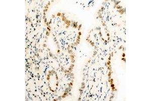 Immunohistochemical analysis of HMGB1 staining in human kidney formalin fixed paraffin embedded tissue section. (HMGB1 anticorps  (N-Term))