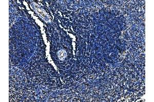 IHC analysis of Cd6 using anti-Cd6 antibody (ABIN7601956).