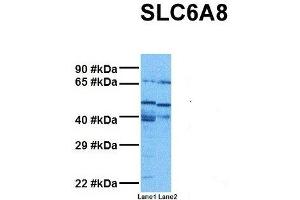 Host:  Rabbit  Target Name:  SLC6A8  Sample Tissue:  Human MDA-MB-435s, Human THP-1  Antibody Dilution:  1. (SLC6A8 anticorps  (N-Term))