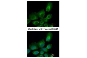 ICC/IF Image Immunofluorescence analysis of paraformaldehyde-fixed A431, using UBE2B, antibody at 1:500 dilution.