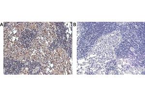 Immunohistochemical staining of human lymphnode tissue using A) anti-IL-33 (human), pAb  and B) anti-rabbit IgG (negative control) . (IL-33 anticorps)