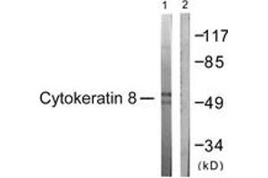 Western blot analysis of extracts from 293 cells, treated with EGF 200ng/ml 30', using Keratin 8 (Ab-431) Antibody. (KRT8 anticorps  (AA 401-450))