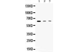 Western blot analysis of AMHR2 expression in rat skeletal muscle extract ( Lane 1), HELA whole cell lysates ( Lane 2) and MCF-7 whole cell lysates ( Lane 3).
