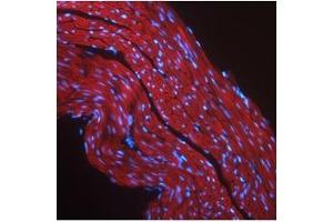 Immunofluorescent IGF1R detection in mouse skeletal muscle (red fluorescence). (IGF1R anticorps  (Middle Region))