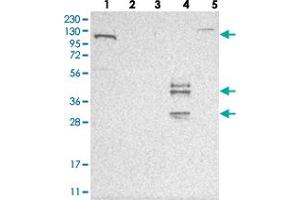 Western blot analysis of Lane 1: RT-4, Lane 2: U-251 MG, Lane 3: Human Plasma, Lane 4: Liver, Lane 5: Tonsil with ESPN polyclonal antibody . (Espin anticorps)